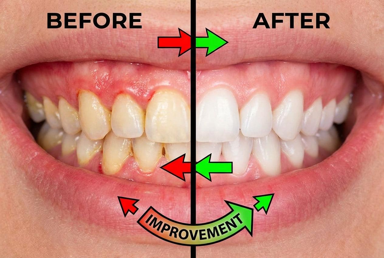 Gum Disease Prevention: The Role of the Portable Oral Irrigator in Your Home Care